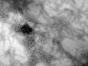 The FapC protein from P. aeruginosa aggregates to form amyloid fibrils.