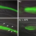 Celegans and Amyloid Experiments