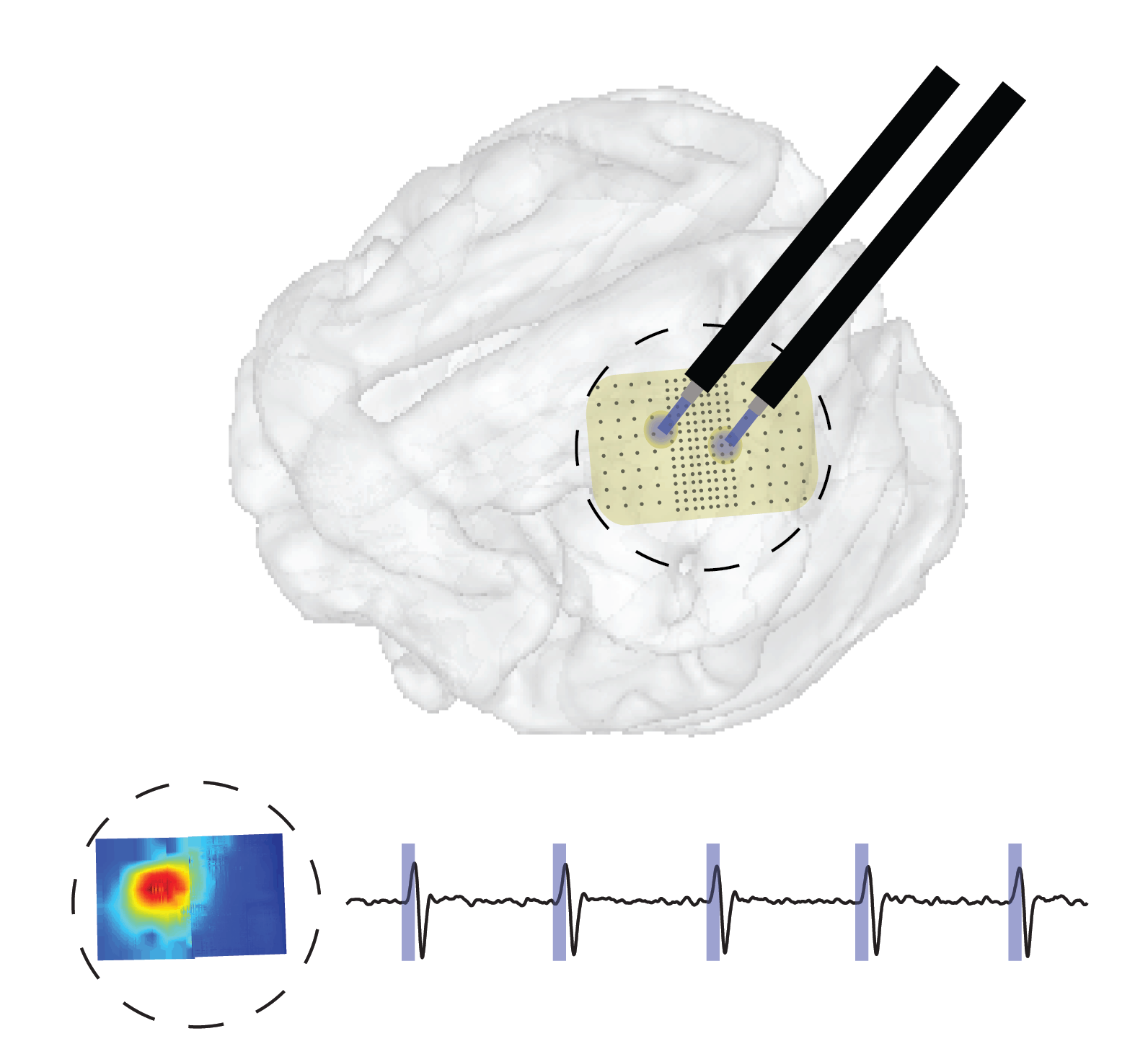 Large scale ontogenetic interface